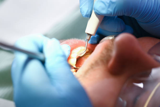 Best Emergency Treatment for Jaw Pain or Injury in Eatonville, WA