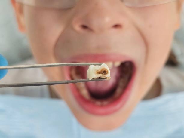 Best Weekend Emergency Dental Services in Eatonville, WA